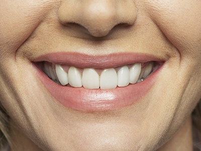 closeup of woman with straight teeth
