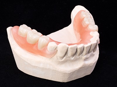 partial denture for multiple missing teeth