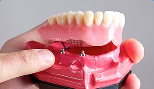 full dental denture model