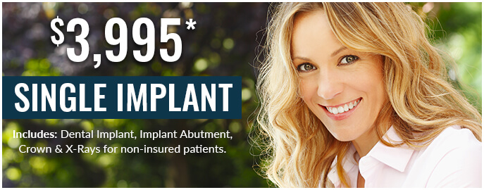 Tysons Dental Implant Offer